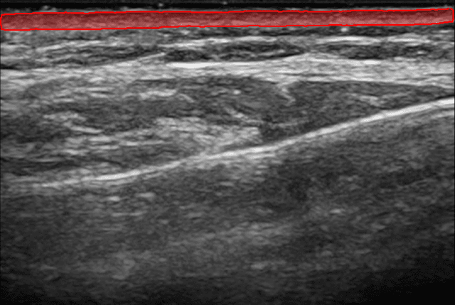 Overview of Dermis Analysis
