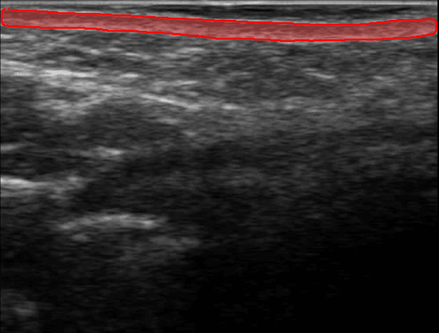 Overview of Dermis Analysis